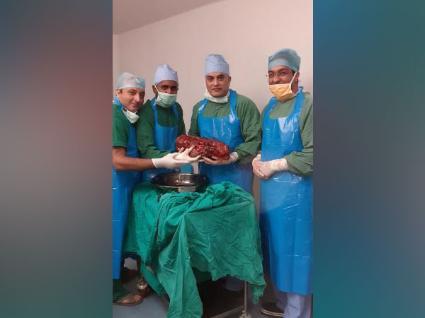 Delhi: Doctors remove world's 3rd heaviest kidney, plan to claim Guinness Book of World Records