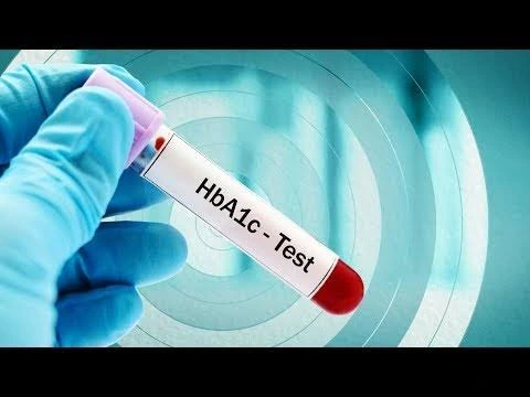 Why Monitoring HbA1c Is Essential for Managing Diabetes?
