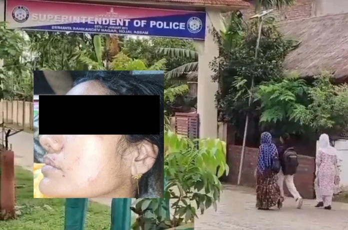Woman alleges torture by husband and in-laws in Lanka, Assam
